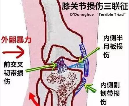 健身练臀有什么好处，健身锻炼臀部的好处