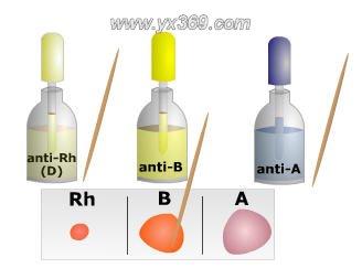 血型是怎么分类的有什么区别