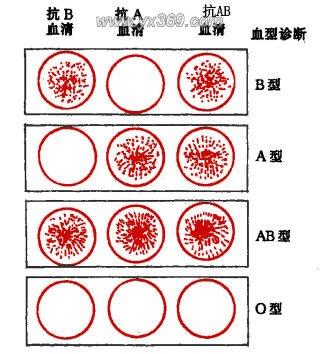 血型是怎么分类的有什么区别