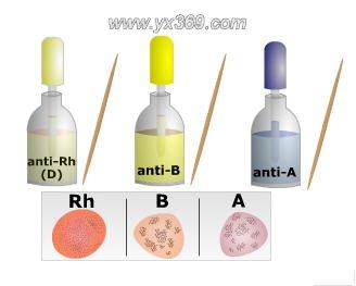 血型是怎么分类的有什么区别