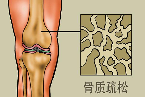 总觉得腰疼是怎么回事