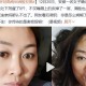 女孩阳后烧了2天自然卷变直发（网友：这是“直发株”吗？）