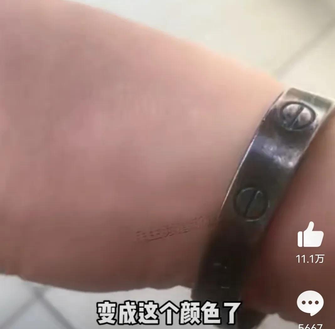 女子退烧后发现银手镯变黑了（银手镯可以排毒?）