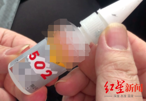 男子使用502胶水不慎烧伤大腿 医生：遇此情况应清水冲洗后及时就医