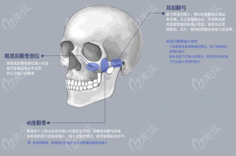 骨相多少钱