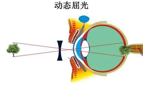 眼视光学学什么意思