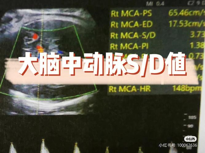 sd中心校长d怎么说