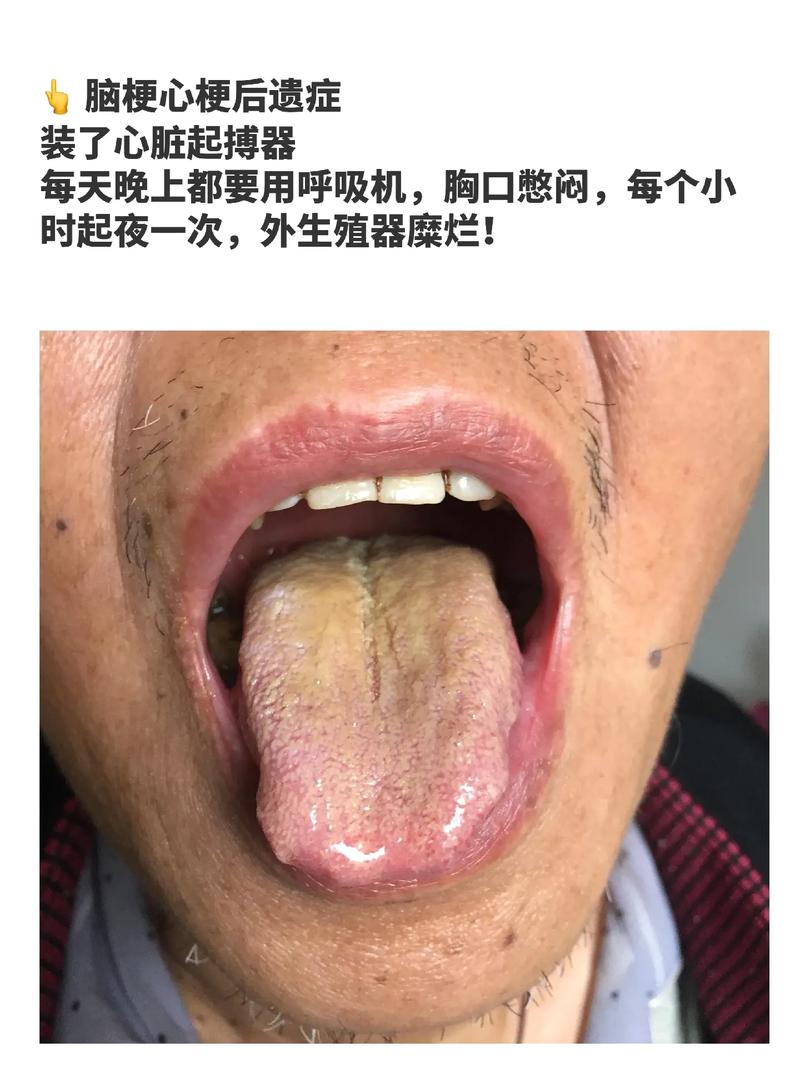 胡兮然多少分